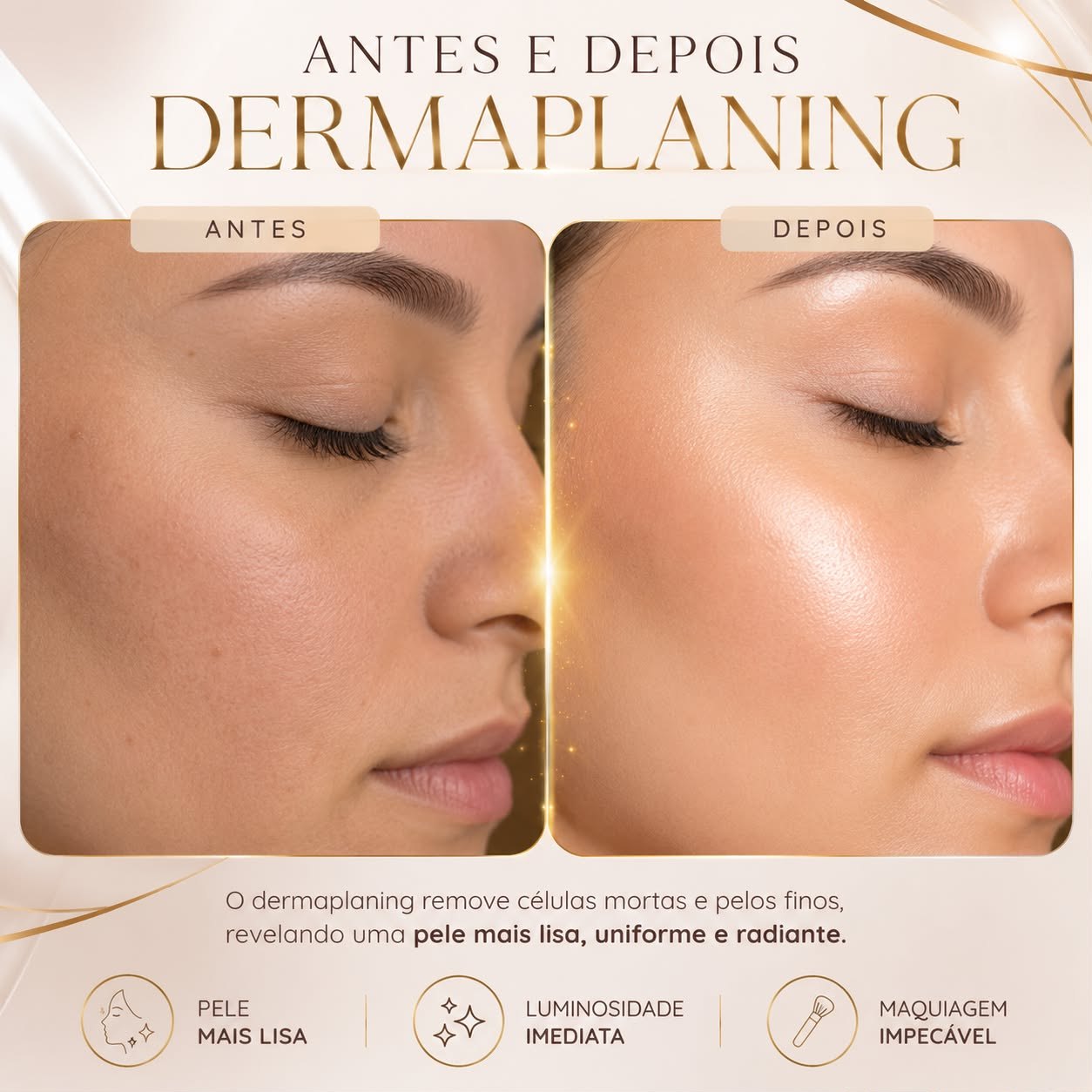 Antes e depois do dermaplaning: pele mais lisa, uniforme e radiante
