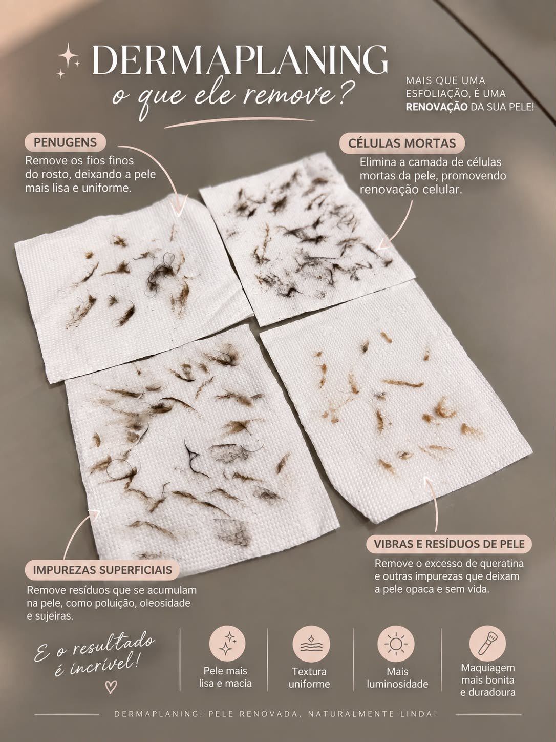 Dermaplaning: o que ele remove — penugens, células mortas, impurezas superficiais e resíduos de pele